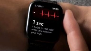 Apple Watch’un EKG özelliği Avrupa ülkeleri için yayınlandı